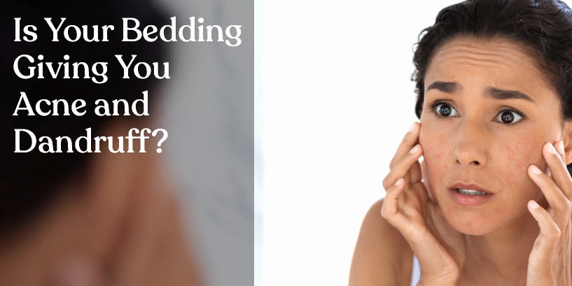 Is Your Bedding Giving You Acne and Dandruff?